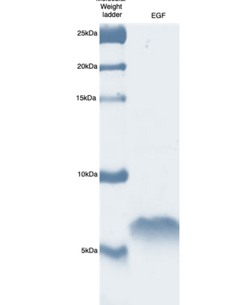 factor de crecimiento epidérmico humano